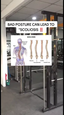 Prevent injuries using Back Posture Corrector #scoliosisawareness #scoliosis  #backposturecorrector #foryoupage #fyp 