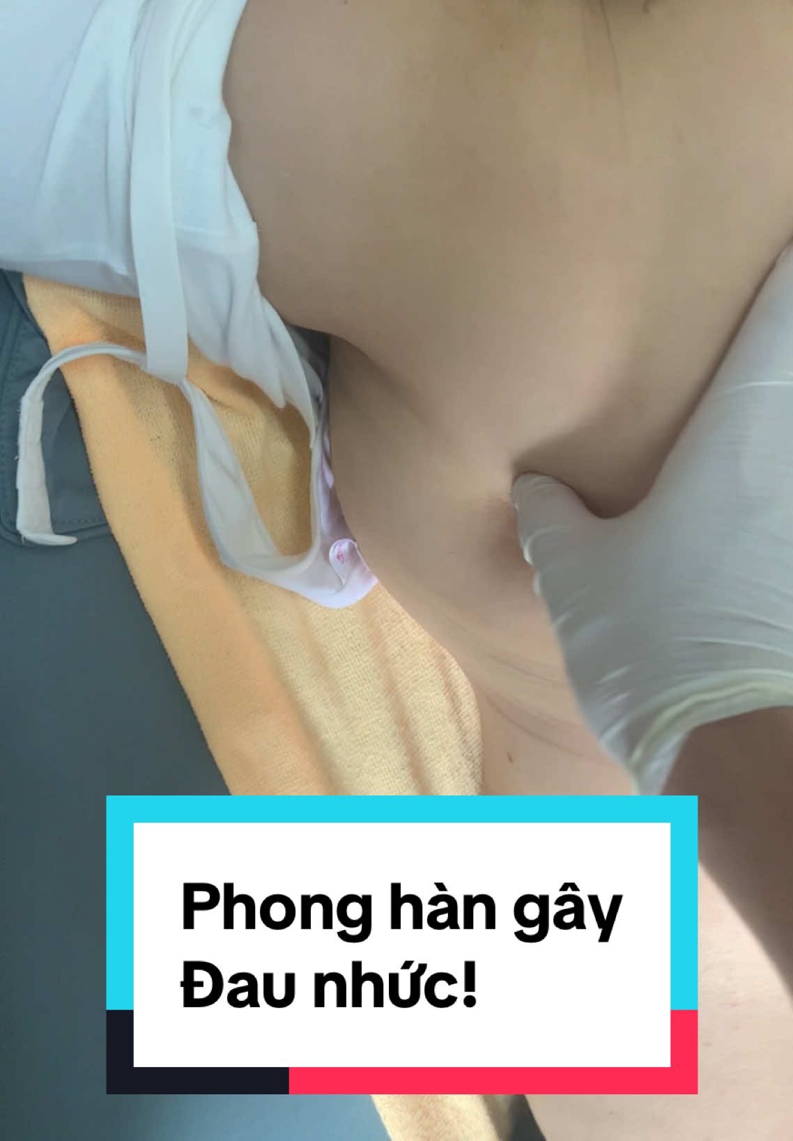 Đau nhức do phong hàn, gây ra hội chứng đau vai gáy, đau lưng #đauvaigáy #đaulưng #phonghàn 