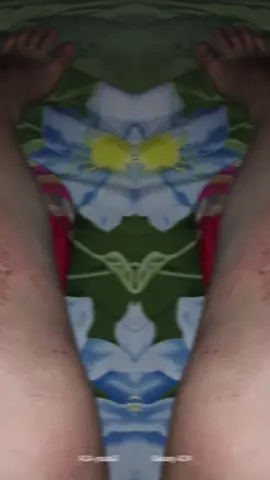 ครั้งแรกในชีวิตพี่รถมอไชค์ล้มในเมืองหลวงและครั้งแรกที่นั่งรถกู้ภัย #แผลเล็กน้อยแต่โครตปวด🥺🥺