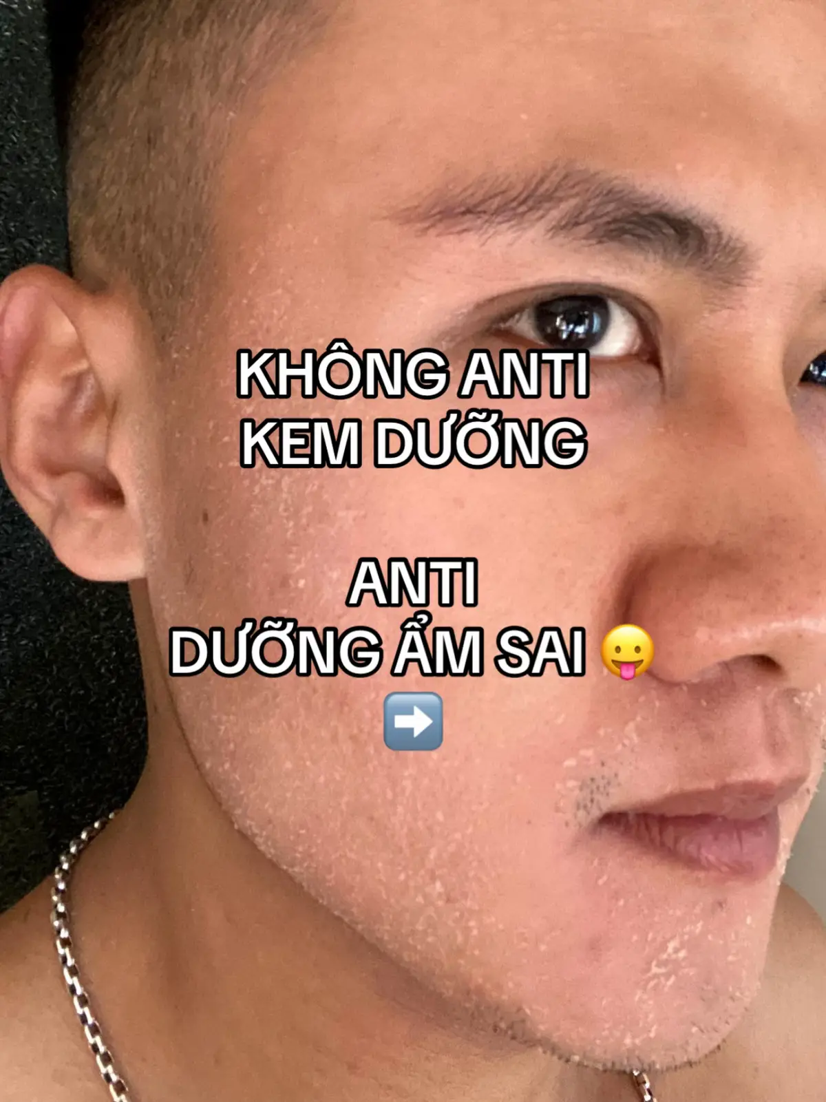 Kem dưỡng tui dùng chục năm trước khi còn là sinh viên 🤗🤗🤗 #naturalmoisturizingfactor #nmf #duongamphuchoi #phuchoihangraobaoveda #theordinary 