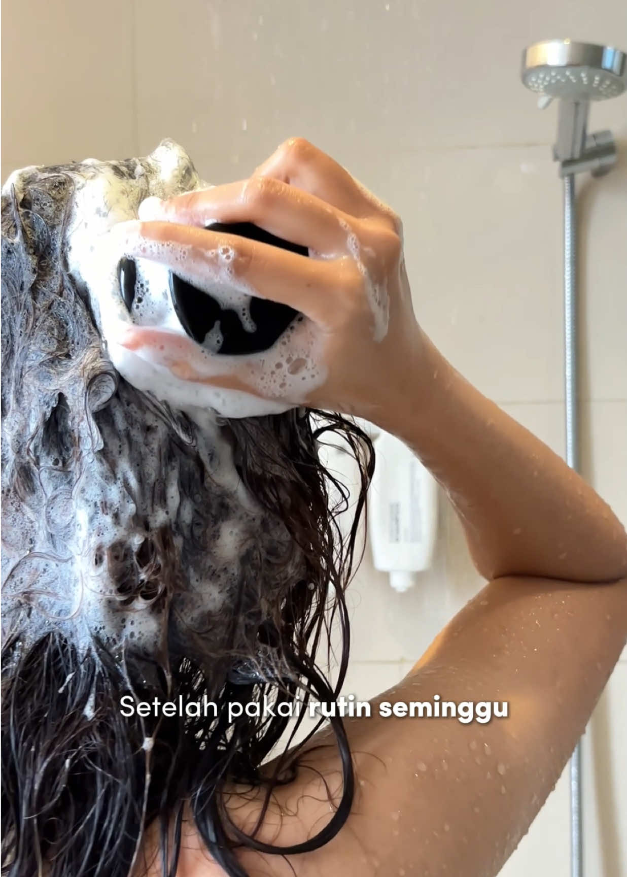 TERNYATA INI BUKAN KETOMBE BIASA🤔 #psoriasiskepala #psoriasis #kulitgatal #shampoonatural #kulitkepalasensitif 