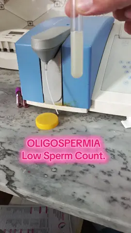 Oligozoospermia Low sperm count.