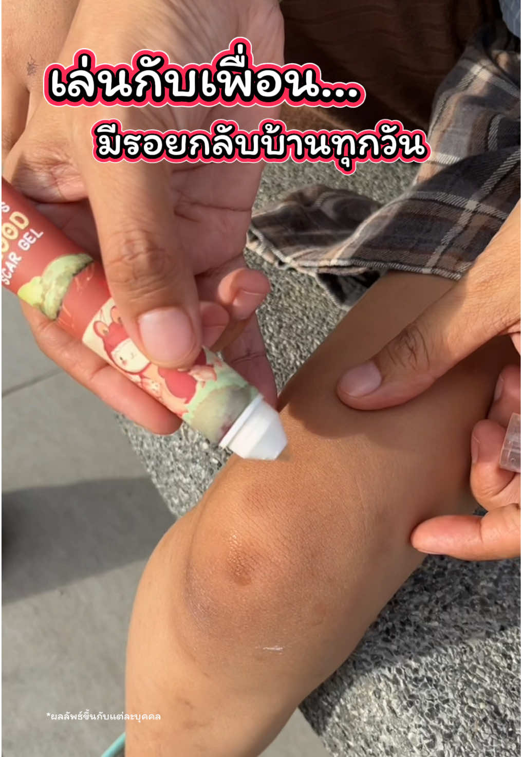 ลูกสาวเล่นกับเพื่อน มีรอยแผลกลับบ้านทุกวัน…  #เจลทาแผล #masterrabbitthailand #masterrabbit  #ดราก้อนบลัด  #มามี้ดั๊กน้องเอด้า 