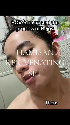 WORTH IT ‼️ CONSISTENCY IS THE KEY.😍 HAMISAN REJUVENATING SET BY @Hami-San by Jolina #hamisan #rejuvanatingset #foryou 
