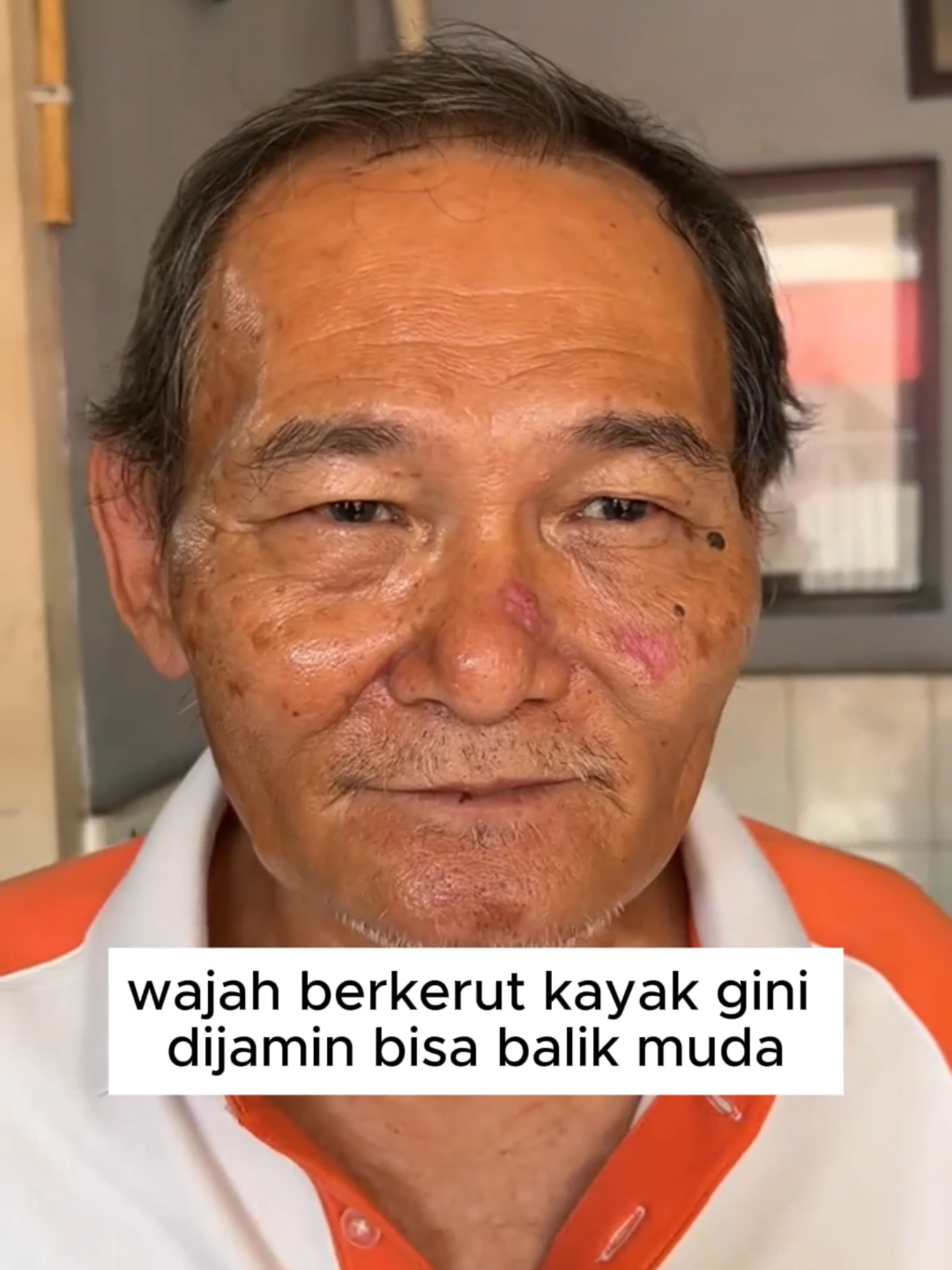 Serum Abera Skin Renewing – anti-penuaan, regenerasi kulit, pulihkan keremajaan! #SerumAberaSkinRenewing #RegenerasiKulit #PulihkanKeremajaan #AntiPenuaan #CantikSemulaJadi #SkincareMalaysia