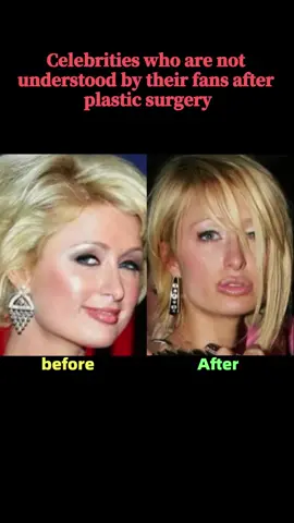 Celebrities who are not understood by their fans after plastic surgery，One of them wouldn't listen to the advice at all？#celebrities #hollywood #actors #fyp #young #star #usa #us #meganfox #lilliangriego 