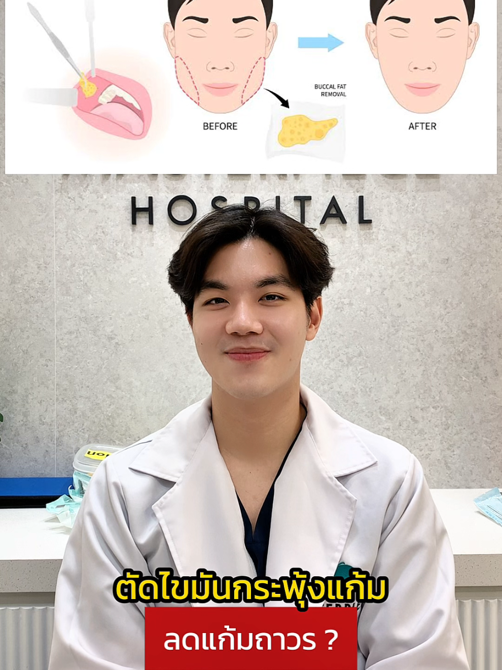 คนที่ต้องการลดแก้มถาวร การตัดไขมันกระพุ้งแก้ม ช่วยได้ไหม? ถาม-ตอบกับ #คุณหมอฟลุ๊คmtp ✅ #หมอฟลุ๊คมาสเตอร์พีช #หมอให้ความรู้ #ไขมันกระพุ้งแก้ม #ตัดไขมันกระพุ้งแก้ม 