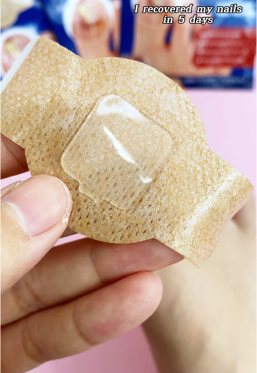 Say goodbye to your ugly nails #fungus #nails #fungal #patches #nailtok #SelfCare #toe #fyp #giftideas #tiktokfinds #tiktokshop 