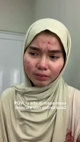 Alhamdulillah udh ga insecure
