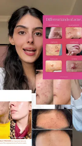 🚫 طريقة الاستخدام :  باليل قبل النوم على  المنطقه المستهدفه.  بعدها مربط 👌🏻✨ #fyp #foruyou #skincare 