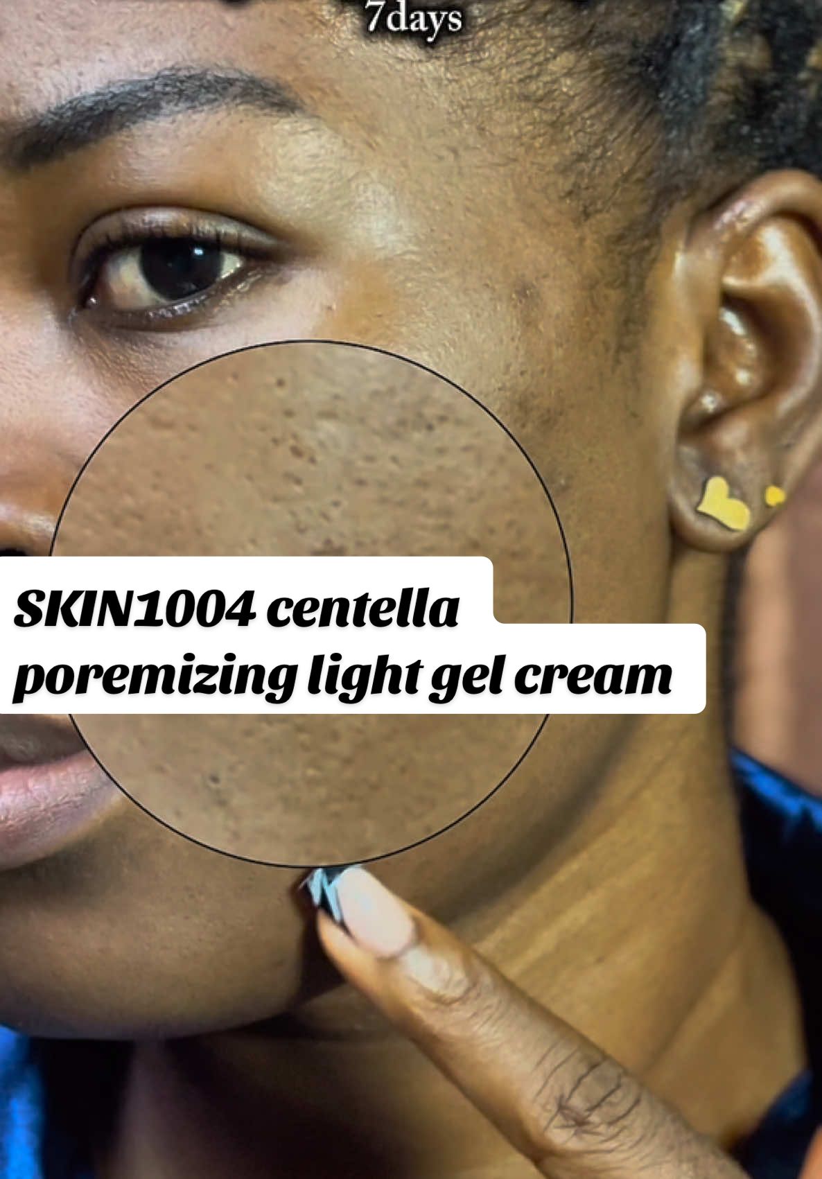Melting the appearance of pores in 7day with the skin1004 centella poremizing light gel cream .. this cream literally melt my pores @SKIN1004 US  #centella #skincare #skin1004 #koreanskincare #skincareroutine #overnightcream #centellaskincare #skin1004 #centella #TikTokMadeMeBuyIt #koreanskincare #kbeauty #skincareroutines 