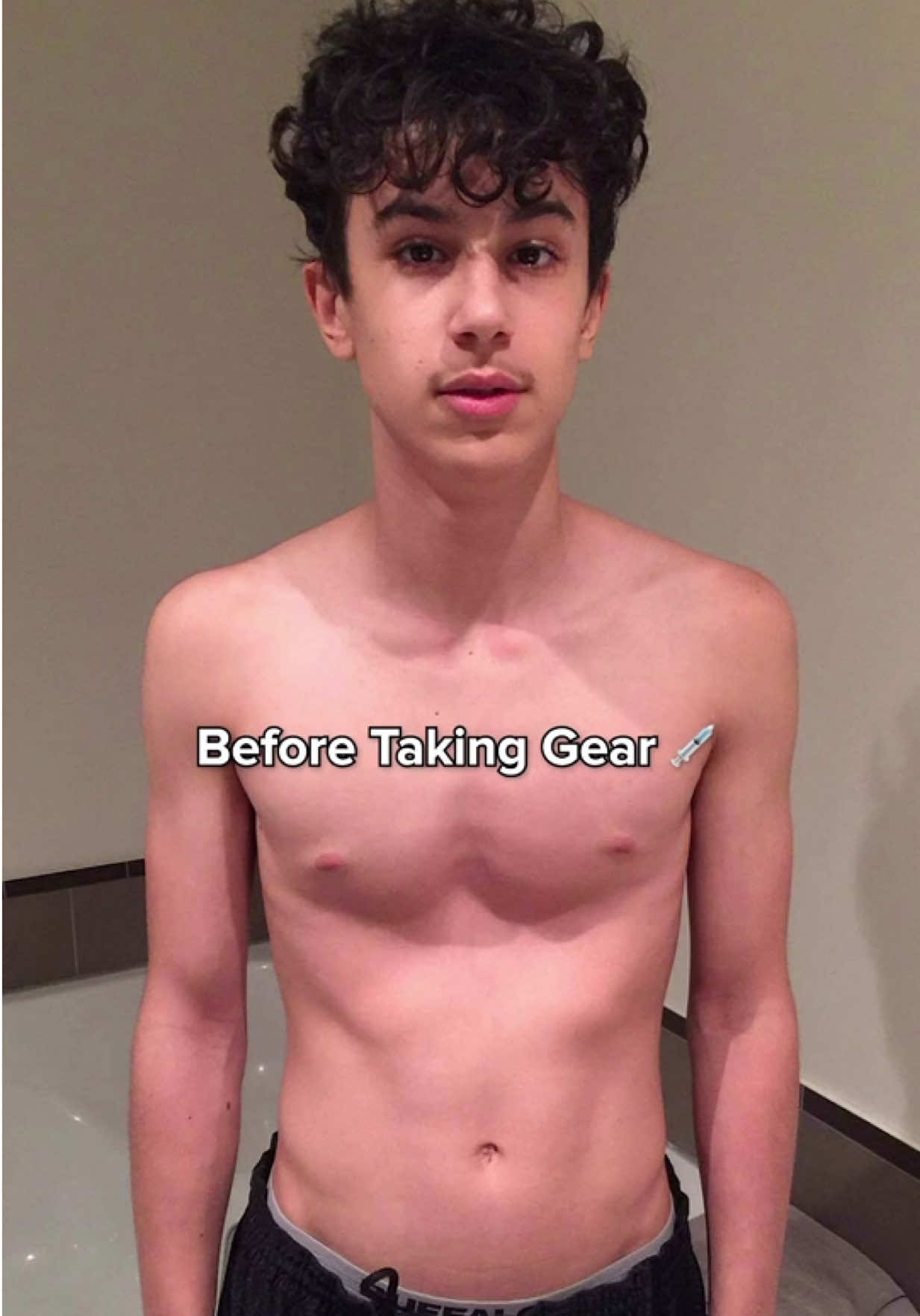 Before Taking Gear 💉 JOIN MY FITNESS COMMUNITY (Link in bio) 🤝 Follow me for more fitness tips & workouts :) #foryou #foryoupage #gymtips #GymTok #workout 