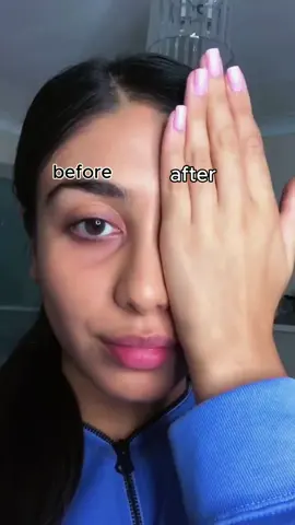 Search for Novoy on Amazon to buy it! Enter 329W7B9E to get 30% off and Novoy eye masks for $9.90 (2025071505) #eyemask #collagen #eyepatches