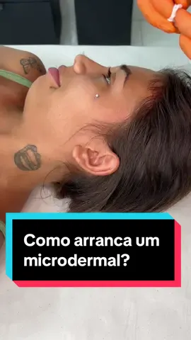 Como é que arranca um microdermal de dentro do cliente?  .Quer concorrer a um pacote de piercings de 2.500,00 concorrendo na nossa rifa? .Quer agendar seu piercing seguro conosco?  .Quer joias ou almofadas? .Quer agendar sua tattoo? .Quer um curso ou workshop com a gente? Envia “QUERO PIERCING” e receba nosso WhatsApp ou já corre no link da bio e fala com a gente! 🧡 Você é mais impulsivo? Estamos abertos de segunda a sábado de 11 às 18, aparece que a gente te atende de acordo com a ordem de chegada. 🙃 Agenda Aberta para perfurações e workshops com o @eusudano : Niterói, São Paulo, Fortaleza, Curitiba, Brasília, Porto Alegre e PORTUGAL! 🔸O Piercing Que Deu Certo🔸 Rua José Clemente, 21, sala 305 Centro de Niterói, RJ #piercingseguro #verticallabret #verticallabretpiercing