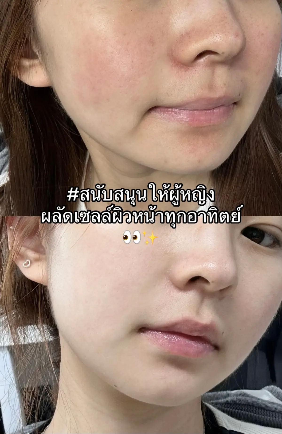 #ป้ายยาtiktok #หน้าใส #เทรนด์วันนี้tiktok 