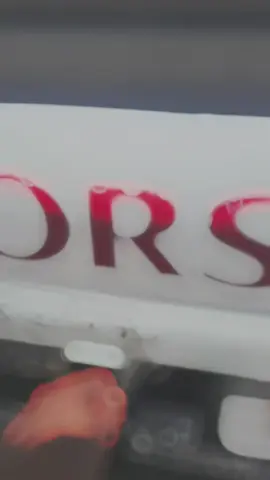 صح عندي كومه جروح تحرك بدمي  بس والله كلها تهون بس تضحك امي