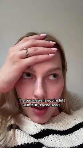 Accutane for acne, skincare for acne scars babyyg #accutane #skincare #skintok #acne #acnescars 