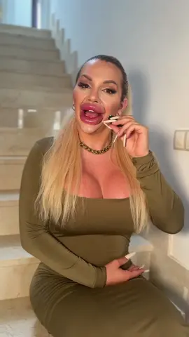 IG: ViennaXtreme #lipinjections #viennaxtreme #botox #trans #viennawuerstel #viennabotox @viennabotox @Jessy Bunny  Bunny @JessyBunny