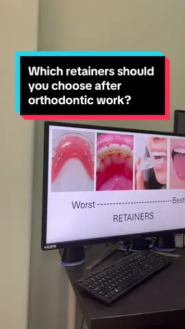 Which retainers should you choose after orthodontic work? #retainers #retainerstruggles #orthodontics #teethtok #toothtok #braces #truth 