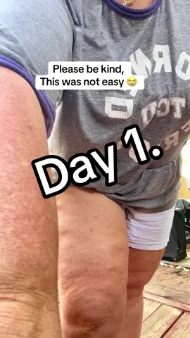 What do you think? #lipedemalegs #lipedema #cellulitetips #cellulitequeen #firmingcream 