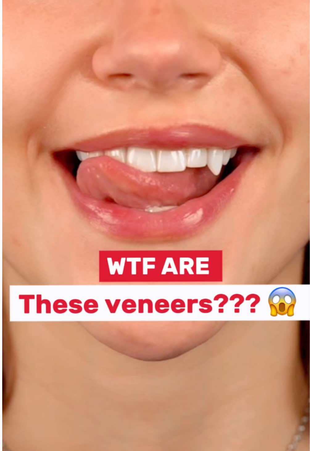 She didn’t want a “natural smile”… She wanted to feel powerful. So we created something unique — Porcelain veneers with vampire canines. 🧛‍♀️ Would you dare to do something like this? #OralHarmony #VampireVeneers #SmileTransformation #PorcelainVeneers #DentalArt #UniqueSmile #ColombiaSmiles #DentalTourism #VeneersColombia #DentalTransformation #HollywoodSmile #BeforeAndAfter #SmileDesign