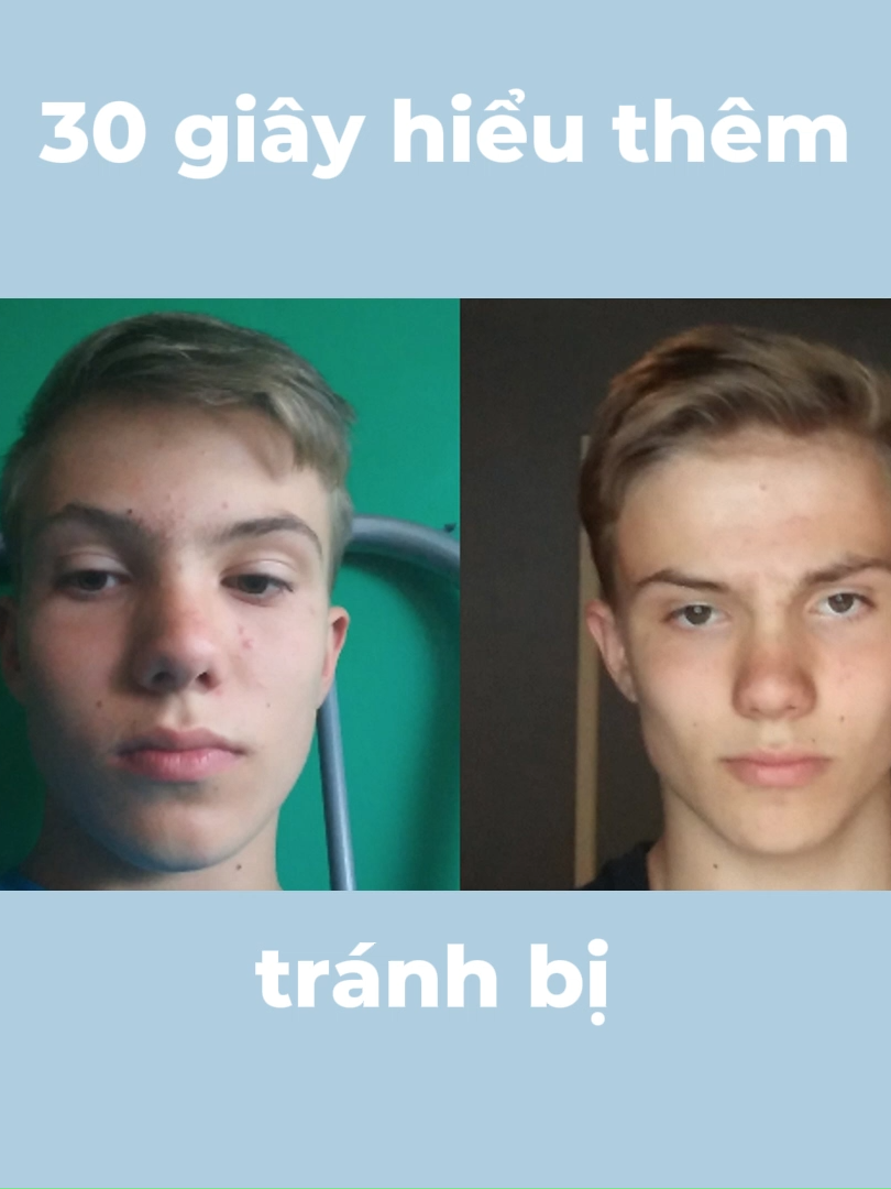 bạn không xấu#tiktokviet #LearnOnTikTok #viral #mewing #faceslimming #GlowUp #xuhuong #facebloat #matlech #photo #anhdep #nongcam #doublechin #lechmat #debloat #chewing #schoolair #fyp