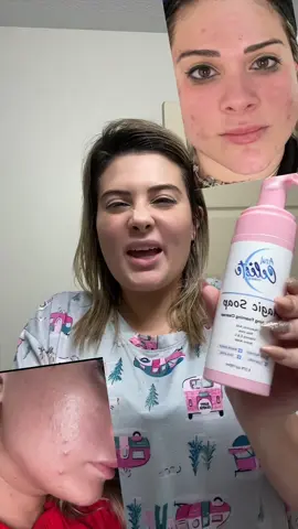 Cleansing Foam #skincare #skincareroutine #acnetreatment #acne #glowskin #skincaretips #creatorsearchinsights #tiktokshop #dealsfordays #tiktokshopsummerturnup #parati #viral #trending #fyp 