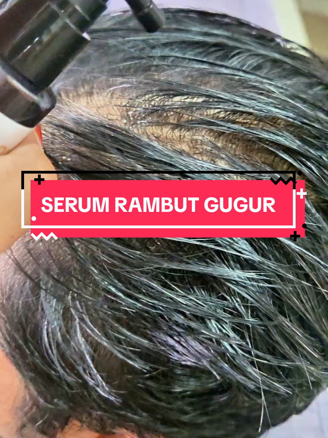 Replying to @drthor70  RAMBUT GUGUR & MAKIN MENIPIS??TRY HAIR SERUM DR VILLE SEBELUM TERLAMBAT... #drville #drvillehaircare #drvilleserum #hairserum #tonikrambut #drvillehairserum 