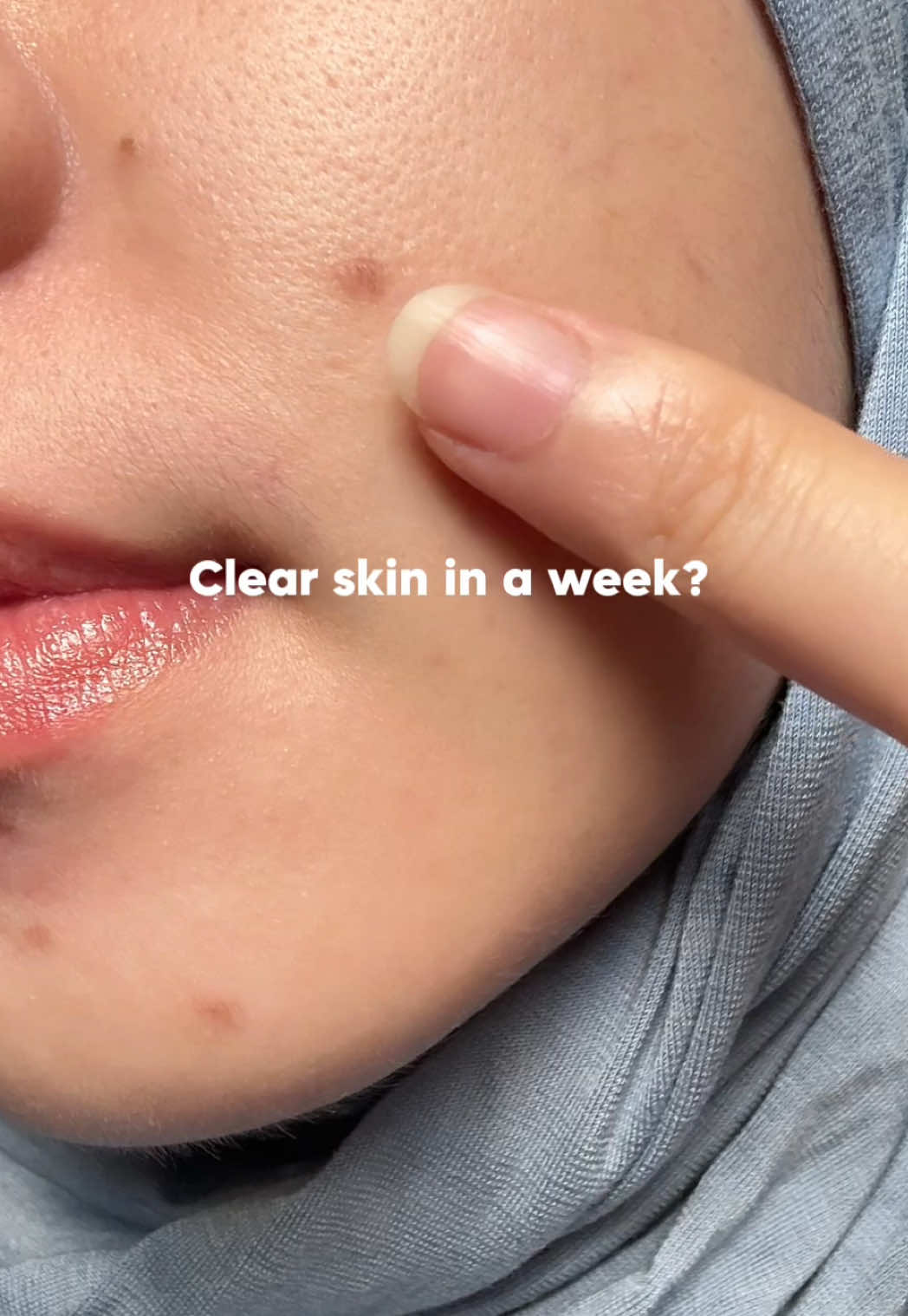 A duo that helps fade dark spots and even out your skin tone🤍 #SKIN1004 #beauty #GlassSkinJourney #kbeauty #kbeautyskincare #fyp  