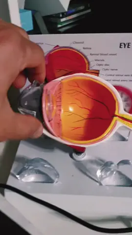 كيف يرى مريض القرنية المخروطية