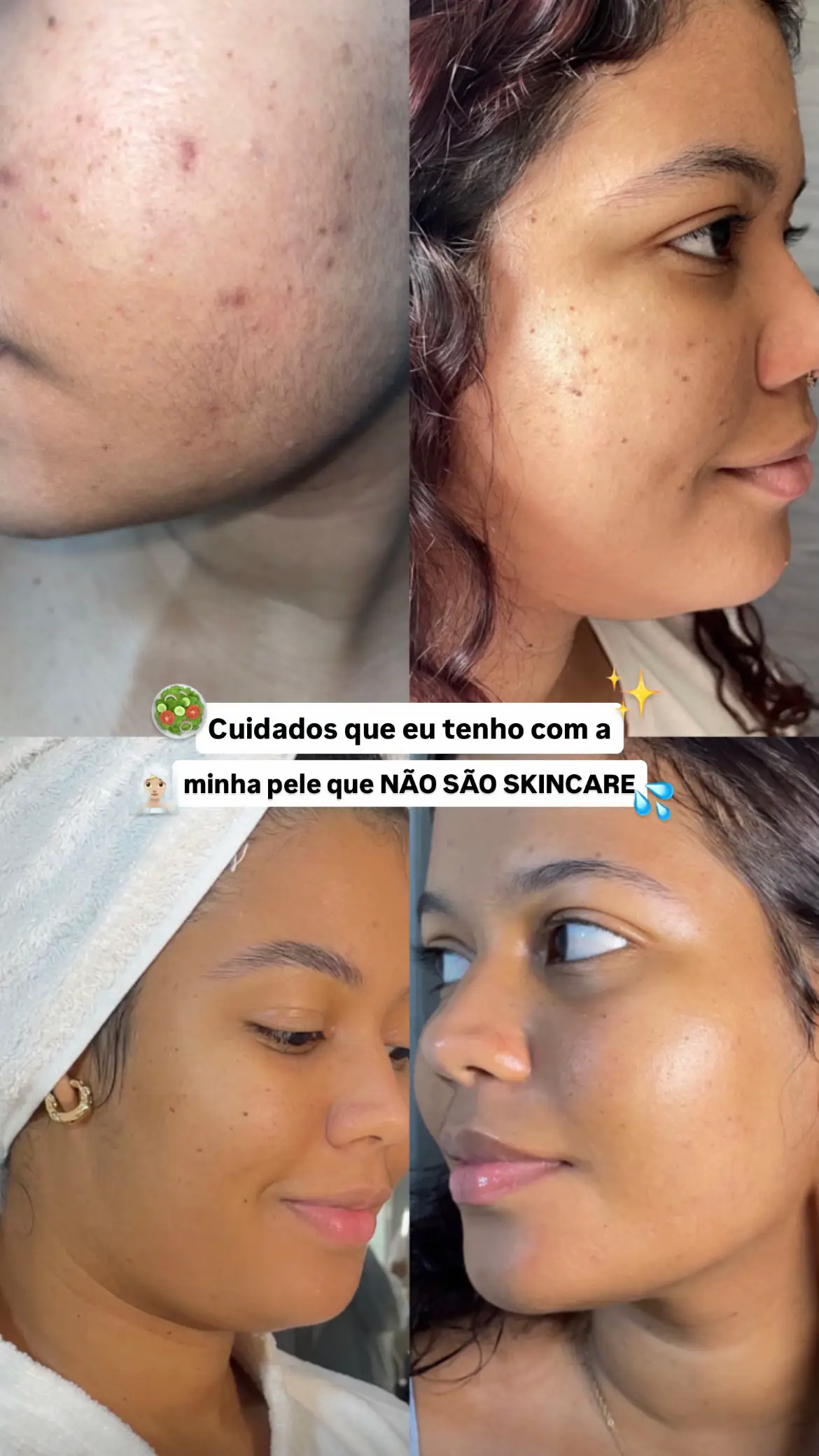 #cuidadoscomapele #dicasdeskincare #pelesaudavel 