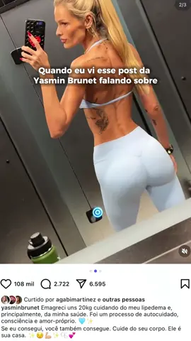 De amiga, para amiga 🤝🏻💌 Filtrar quem você segue nas redes sociais, vai transformar a sua jornada com o Lipedema.  #lipedema #autocuidado #autoaceitação #autoestima #obesidade 