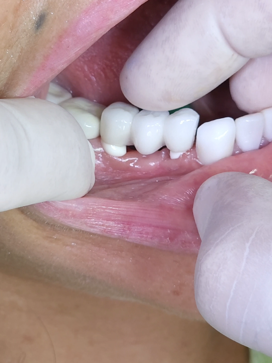 #LearnOnTikTok #طبيب_تيك_توك #fyp 