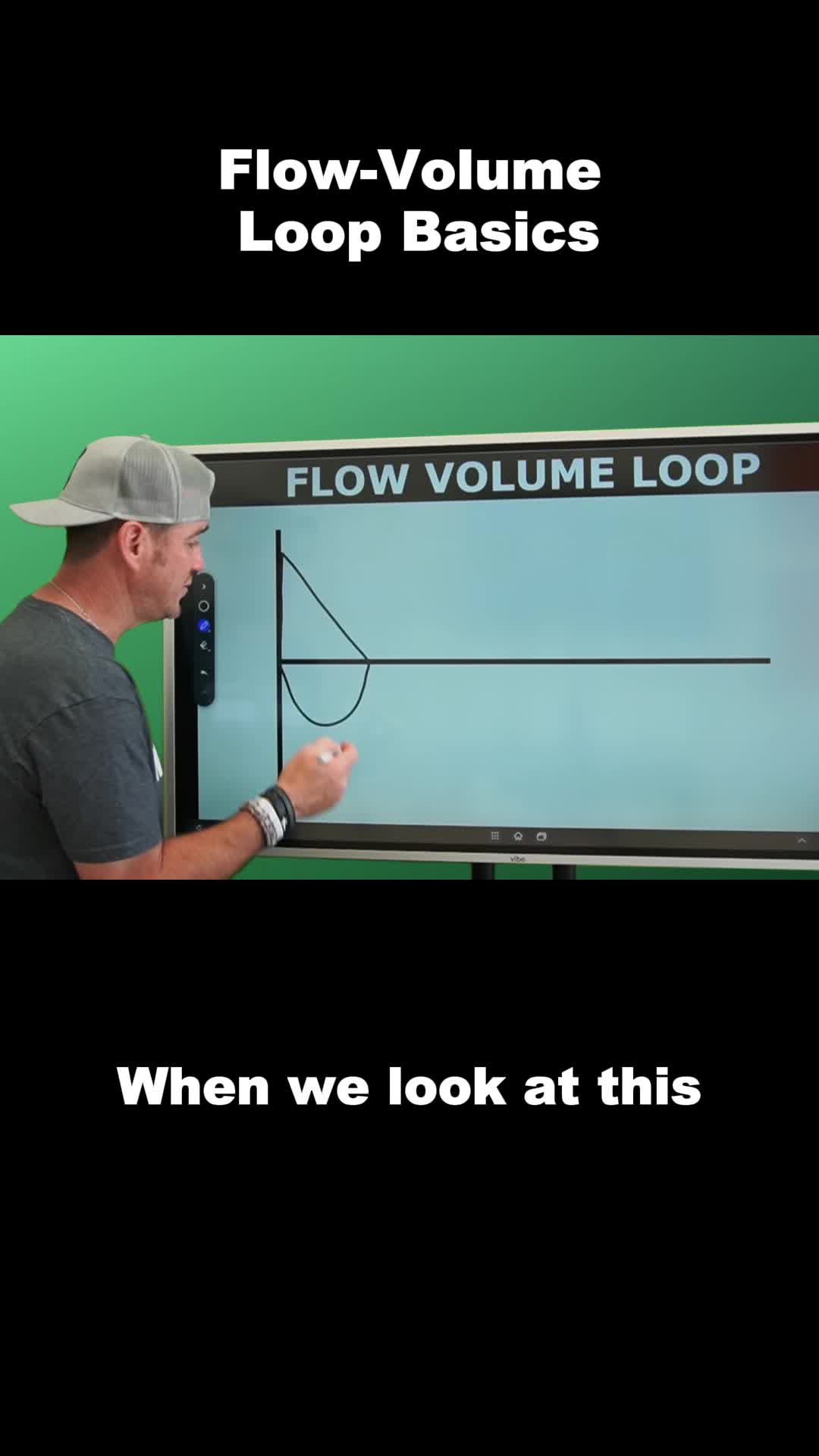 Think you’ve got flow-volume loops down? Knowing the normal is just the beginning—you also need to recognize when something’s not right. This reel walks through a standard loop and introduces the “scoop in the loop” visual cue to help you spot obstructive lung disease fast. 🫁 📺 Full YouTube Video: Respiratory Therapy – Flow-Volume Loop @aarccenter #aarc #FutureRT #RTStudent #RespiratoryTherapy #RTSchool #FlowVolumeLoop #ObstructiveLungDisease