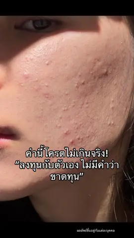 ครีมโสมมที่จริงใจ หน้าโครตฉ่ำ! #หน้าใส #ป้ายยาtiktok #แพ้ง่ายใช้ได้ #ผิวเรียบเนียน #ครีมโสมไฮยา #สิว #สิวหาย 