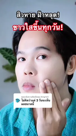 ตอบกลับ @King123 ขอบคุณที่รีวิวค่ะ🙏🏻🥰ใสขึ้นทุกวัน!#kiso#หน้าขาวใส#วันหยุดของฉัน#วันหยุด#chelsea