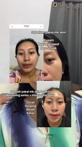 Real testi pemakaian mk skin😍❤️ @maharanikemala  #mkskinofficial #mkskinbali #mkskin 