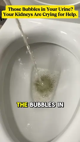 Foamy urine