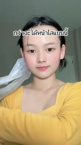 อดทน+วินัย  ##ฟืด##หน้าใส#รักษาสิว 