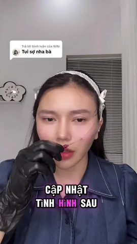 Trả lời @NiNi căng chỉ nâng cơ quả táo hiệu quả ra sao đây là câu trả lời ạ #fypシ゚ #fyp #làmđẹp 