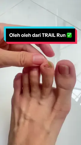😆😆😆✅ Copot kuku kaki kuuuu • #trail #trailrun #kuku #kaki 