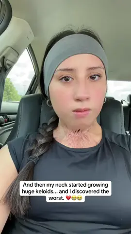 💔 #woman #women #mother #mom #daughter #hospital #family #surgery #beauty