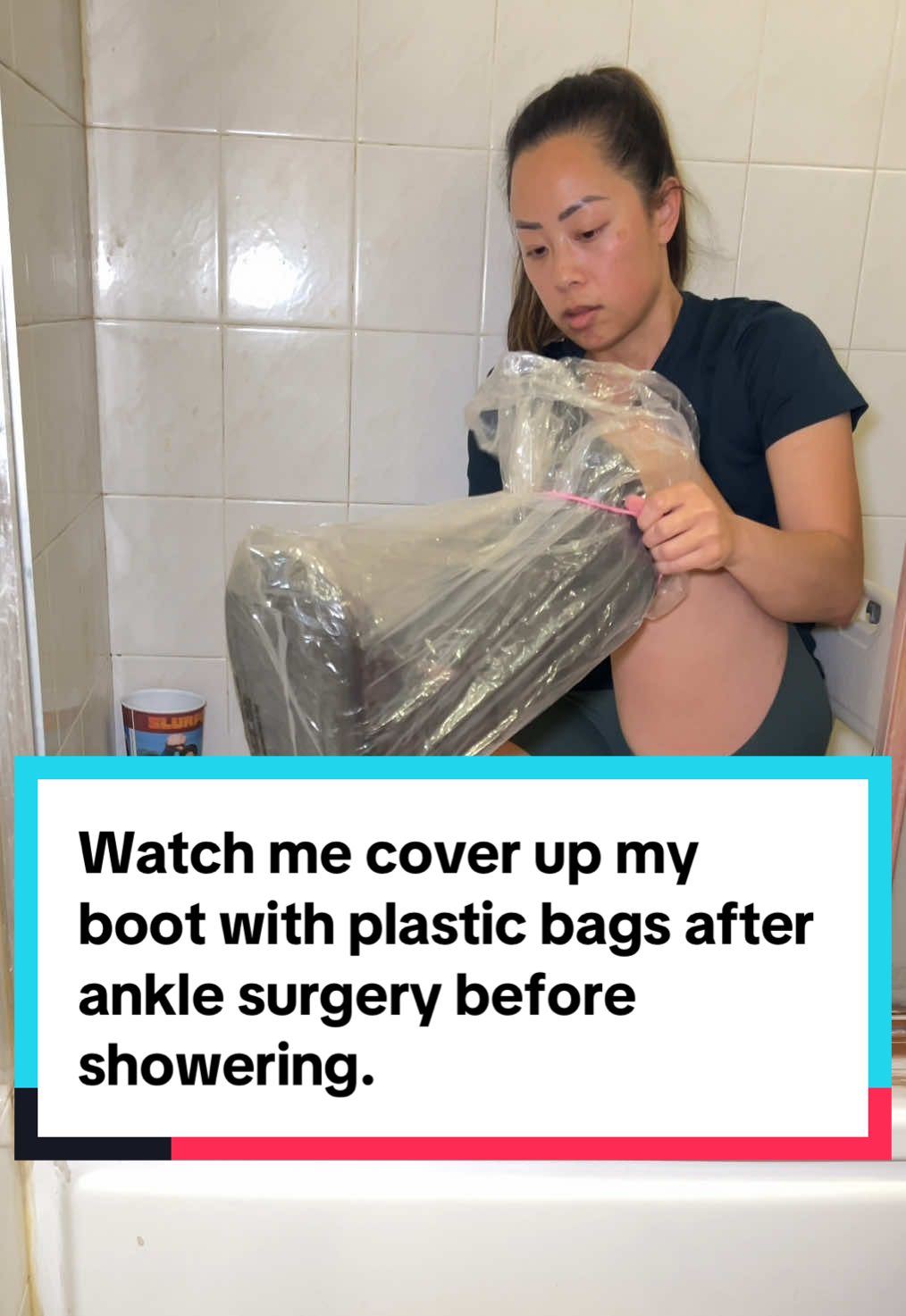 Pre-shower boot cover up setup to prevent the scar from getting wet/infected!
