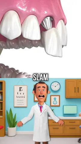 What Happens When You Lose an Adult Tooth and Get a Dental Implant? #healthy #implant #tooth #dentist 
