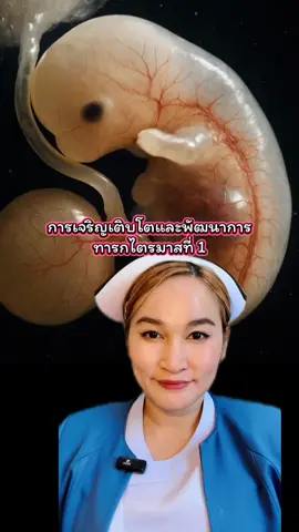 #1month #2months #3month #อาการคนท้องระยะเเรก👶 #ทารก #ทารกแรกเกิด #ทารกเป็นสิ่งมีชีวิตที่น่าอัศจรรย์ #ทารกน่ารัก #ทารกในครรภ์ #ทารกน้อย #ทารกแรกเกิด👶 #พยาบาลยูโกะ  @พยาบาลยูโกะ ปรึกษาเรื่องสุขภาพ  @พยาบาลยูโกะ ปรึกษาเรื่องสุขภาพ  @พยาบาลยูโกะ ปรึกษาเรื่องสุขภาพ 