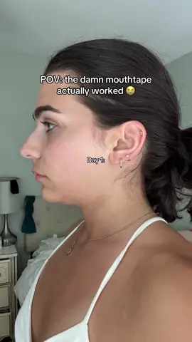 I’m in LOVE #jawline #mouthtape #transformation #beforeandafter #tiktokshopcreatorpicks 