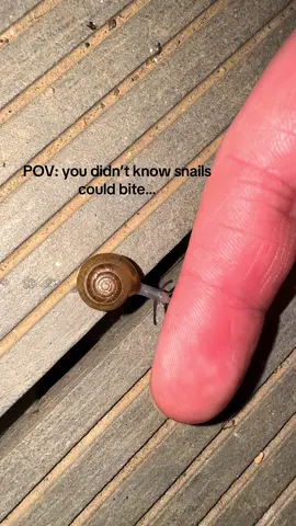 We were supposed to be friends😩🐌 #snail #funnyvideo #fail #unexpected #fyp