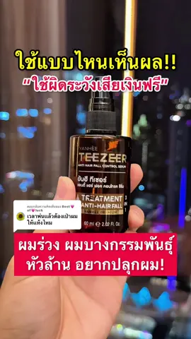 ตอบกลับ @Best💗of💗luck ใช้แบบไหนเห็นผล ผมร่วง หัวล้าน ผมบางอยากปลูกผมลองสูตรรพ.ยันฮี#ผมร่วง #หัวล้าน #ผมบาง #ผมดกผมหนา #เซรั่มปลูกผม #สต๊าฟยันฮี #fani654 