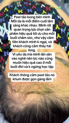 Peel tảo bong bên mình Mỗi da là mỗi điểm cuối lâm sàng khác nhau. Mình rất quan trọng lựa chọn sản phẩm hiệu quả tối ưu cho mỗi buổi chăm sóc, như vậy cầm tiền khách mình k ngại, và khách cũng cảm thấy hài lòng.  Vì yêu da mà mình lấn sân vào nghề nên lúc nào củng muốn hiệu quả cao ở mỗi buổi đtri và k ngừng học tập Khách thông cảm peel tảo nó khum được gọn gàng lắm.#spa #đẹpda #spathuduc #ilovetiktok #tiktok #tảo #peel 