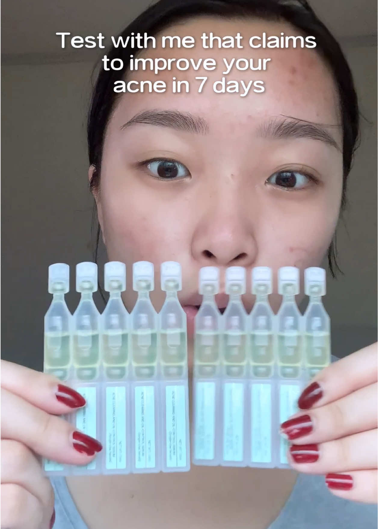 Saw this on my fyp and didn’t expect the effects- watch the full vid to know! #fyp #trending #pov #acnejourney #jmcyxteashell #teashellacneserum 